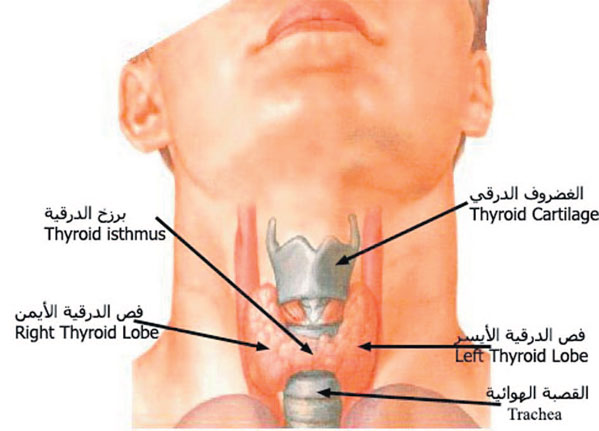 اعراض تضخم الغده , علاج الغده الدراقيه