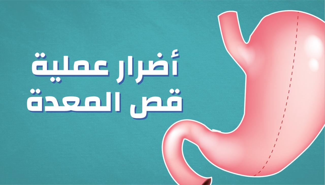 اضرار قص المعده , عملية عليها جدل كبير