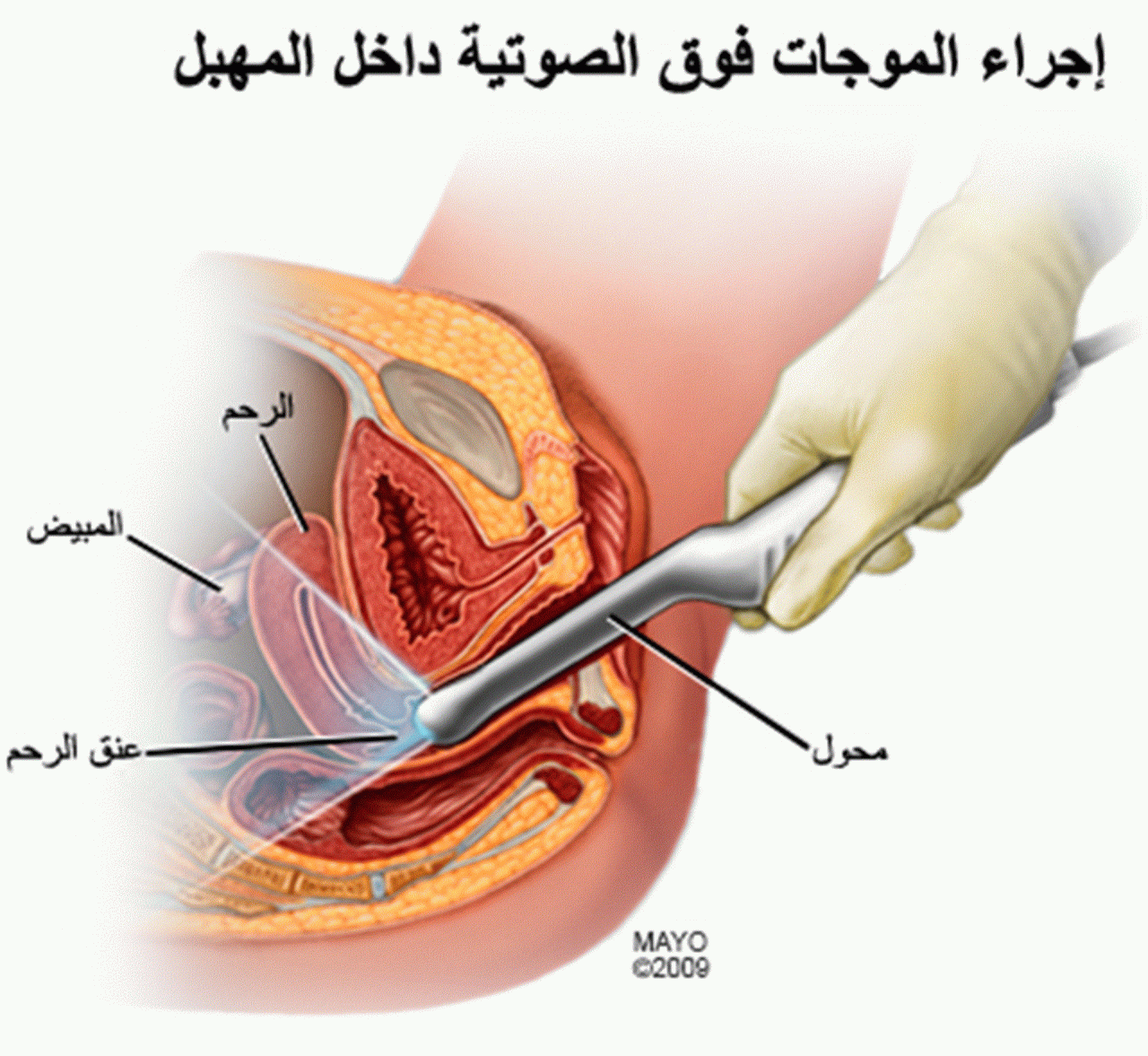 هل يمكن لغشاء البكارة ان يلتئم - هل يتكون غشاء بكاره جديد بعد فضه 2694