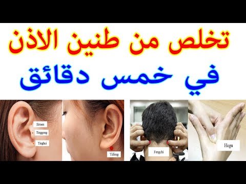 كيف اتخلص من طنين الاذن , هل يوجد علاج طبي لطنين الاذن كما هو شائع