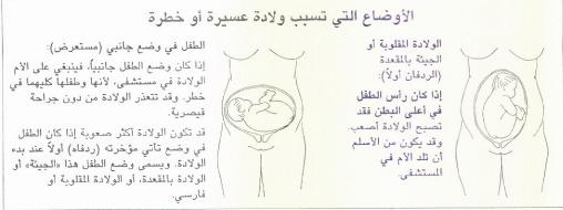 نزول الماء من الحامل , كوني حذرة فقد تكوني على وشك الولادة